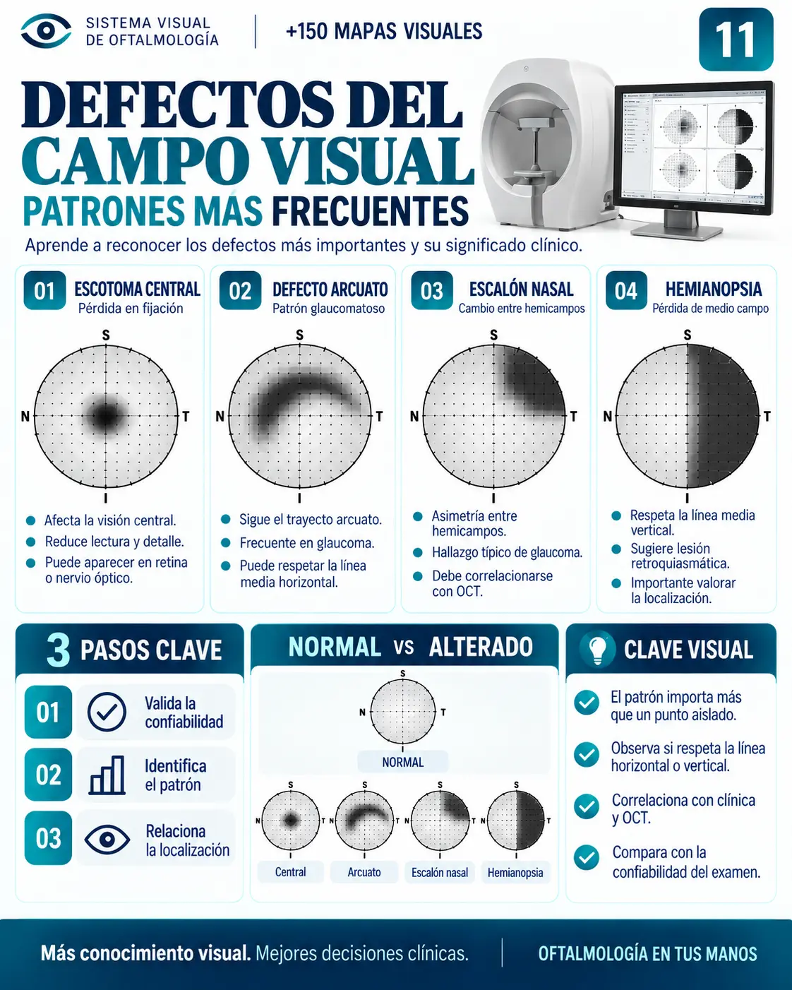 Mapa visual 11: Defectos del Campo Visual — Patrones más frecuentes