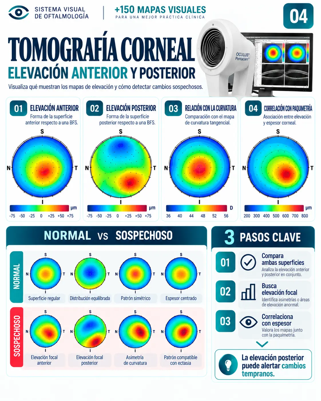 Mapa visual 04: Tomografía Corneal — Elevación anterior y posterior