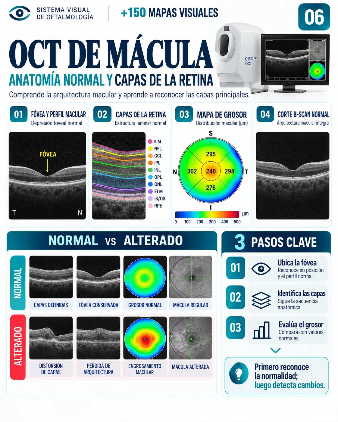 Mapa visual 06: OCT de Mácula — Anatomía normal y capas de la retina
