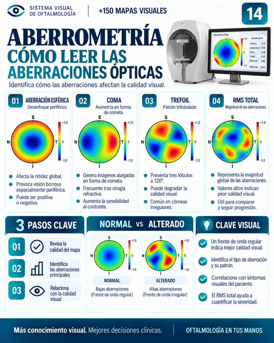 Mapa visual 14: Aberrometría — Cómo leer las aberraciones ópticas